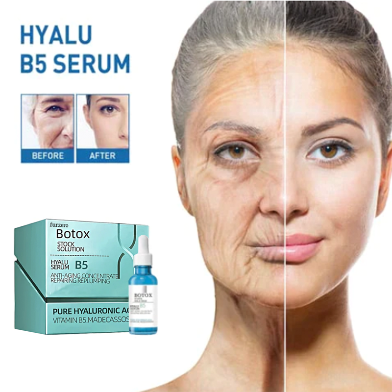 šLast Day Promotion 70% OFFš-Furzero⢠Botox Facial Essence
