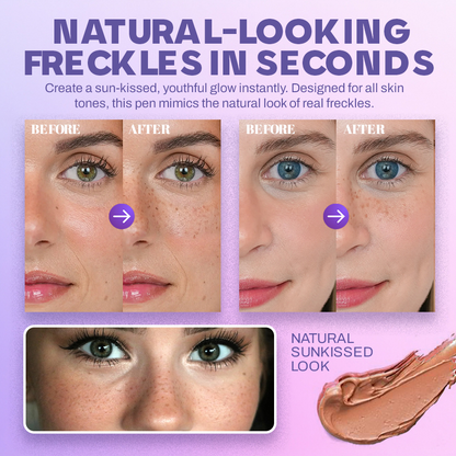NEGUSY™ Quick & Easy Freckles