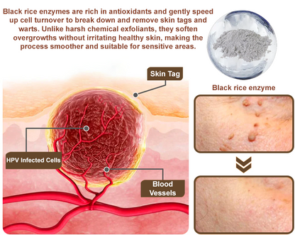 Black Rice Skin Repair Essence Cream 👨‍⚕️ FDA Certified (Removes warts and skin growths, improves keratin buildup and seborrheic dermatitis, follicular keratosis, age spots, and bruising)