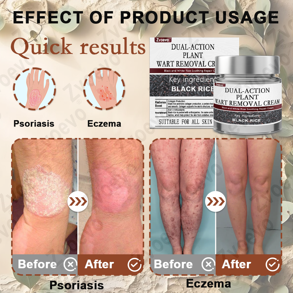 Black Rice Skin Repair Essence Cream 👨‍⚕️ FDA Certified (Removes warts and skin growths, improves keratin buildup and seborrheic dermatitis, follicular keratosis, age spots, and bruising)