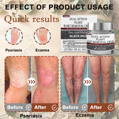 Black Rice Skin Repair Essence Cream 👨‍⚕️ FDA Certified (Removes warts and skin growths, improves keratin buildup and seborrheic dermatitis, follicular keratosis, age spots, and bruising)