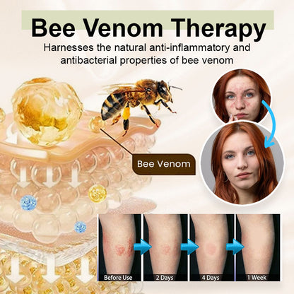 Seurico™ Bee venom tallow cream