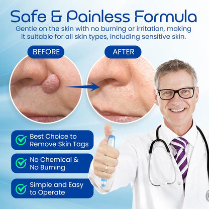 Skin Tag Remover