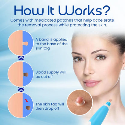 Skin Tag Remover